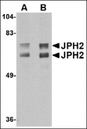 AP23013PU-N - Junctophilin-2 / JPH2