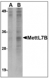 AP23002PU-N - METTL7B
