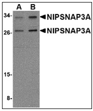 AP23003PU-N - NipSnap3A / NipSnap4