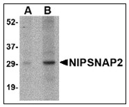 AP23004PU-N - NIPSNAP2 / GBAS