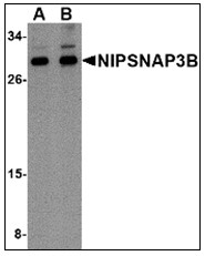 AP23006PU-N - NipSnap3B