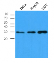 AM09388PU-N - Carbonyl reductase 1