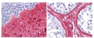 R1040 - Collagen type III alpha 1 chain