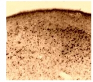 SP5198P - Estrogen receptor beta