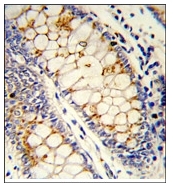 AP17742PU-N - SFRS1 (SF2)