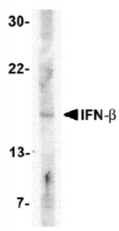 AP05706PU-N - IFNB / Interferon beta