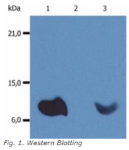 BM604PE - Beta-2-microglobulin