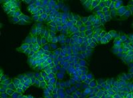 AM26027PU-N - Catenin beta-1