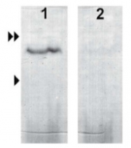 AP23440SU-N - Uroguanylin
