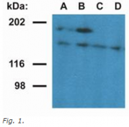 AM26039PU-N - Ubinuclein-1 (UBN1)
