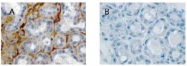 AP23448SU-S - Relaxin receptor 1 / RXFP1