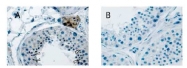 AP23449SU-N - Relaxin receptor 2 / RXFP2