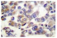AP06617PU-N - WNT1