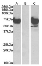 AP23655PU-N - EPM2AIP1