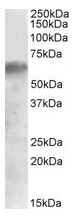 AP23663PU-N - IRF2BP1