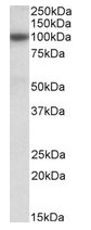 AP23671PU-N - ABCC4 / MRP4