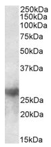 AP23674PU-N - Galectin-3
