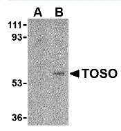 AP05598PU-N - FAIM3 / TOSO