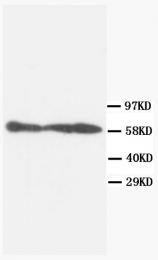 AM20596PU-N - PPP3CA / Calcineurin A