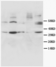 AM20616PU-N - Cyclin D1