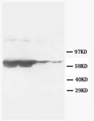 AM20624PU-N - GFAP