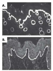 AP02276PU-S - Collagen type VII