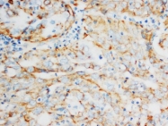 AM20630PU-N - HSP60