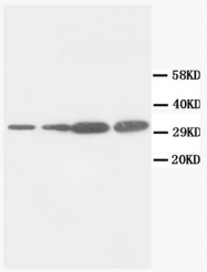AM20660PU-N - PCNA