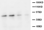 AP23421PU-N - Muscarinic acetylcholine receptor M2