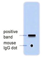 AM20710PU-N - GFP