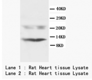 AP23398PU-N - Phospholamban
