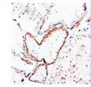 AP23368PU-N - Placenta growth factor / PGF
