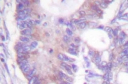AP06478PU-N - Vimentin