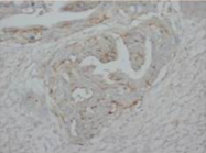 AP23318PU-N - Tumor protein p73 (TP73)