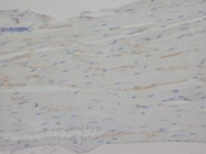 AP23303PU-N - C-reactive protein (CRP)
