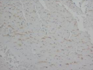 AP23294PU-N - Annexin A5 / ANXA5
