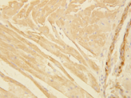 AP23240PU-N - pan Actin