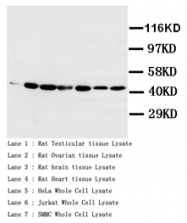 AP23240PU-N - pan Actin