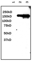 AM20838PU-N - GFP