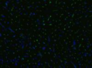 AM03092PU-N - CD105 / Endoglin