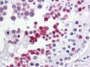 AM21017PU-N - TP53RK