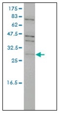 AM21017PU-N - TP53RK