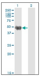 AM21000PU-N - Cytokeratin 20