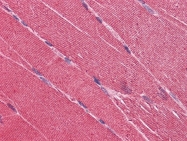 AM21002PU-N - EDEM2