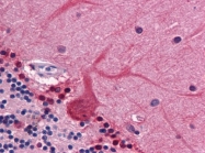 AM21006PU-N - Coronin-1B