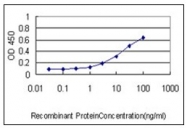 AM21006PU-N - Coronin-1B