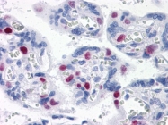 AM21016PU-N - EPSTI1