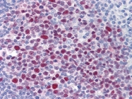 AM21016PU-N - EPSTI1