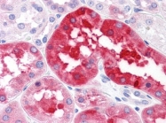AM21023PU-N - RNF144B