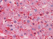 AM21023PU-N - RNF144B